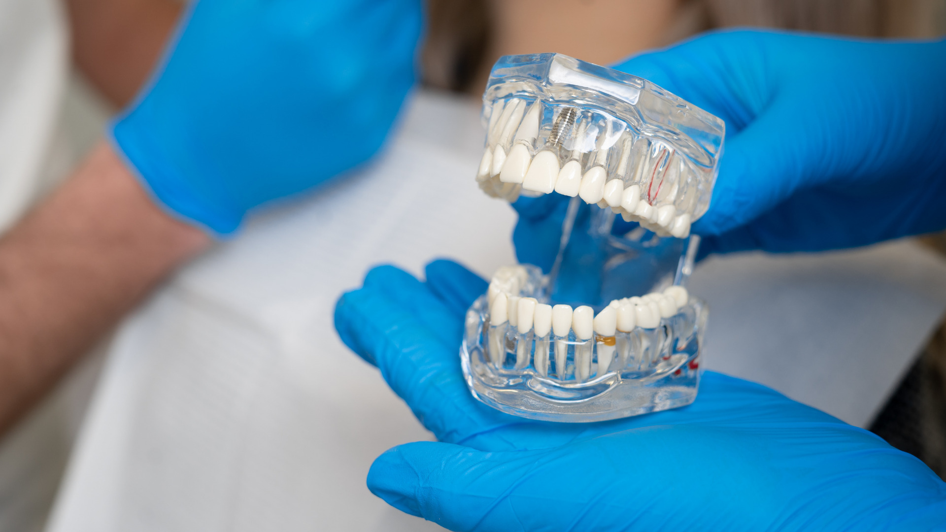 Çene Ortodonti Nedir?