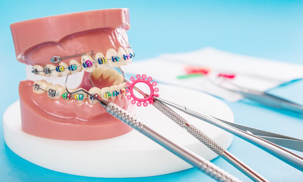 Ortodontik Tedavi Fiyatları